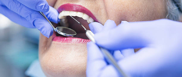 Best Chipped Tooth Repair Near Me  in Benton, LA